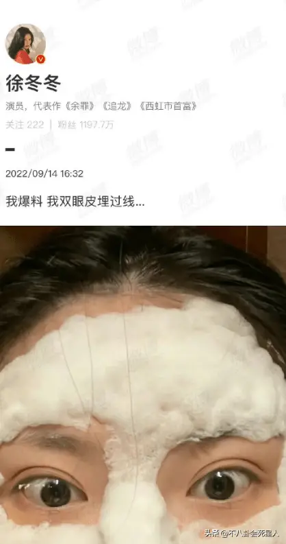 娱乐圈女星整容事件_女明星整容吗_徐冬冬戚薇景甜乔欣周笔畅张檬王鸥谢依霖